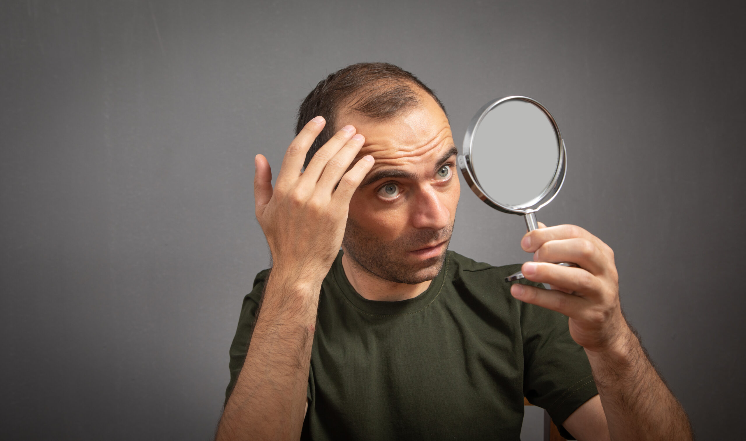 male hair pattern